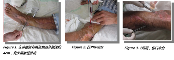 from clipboard from clipboard